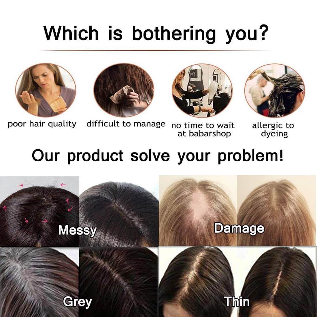 Customize Human Hair Toppers
